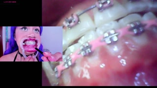 Lila Jordan, suspenders, braces